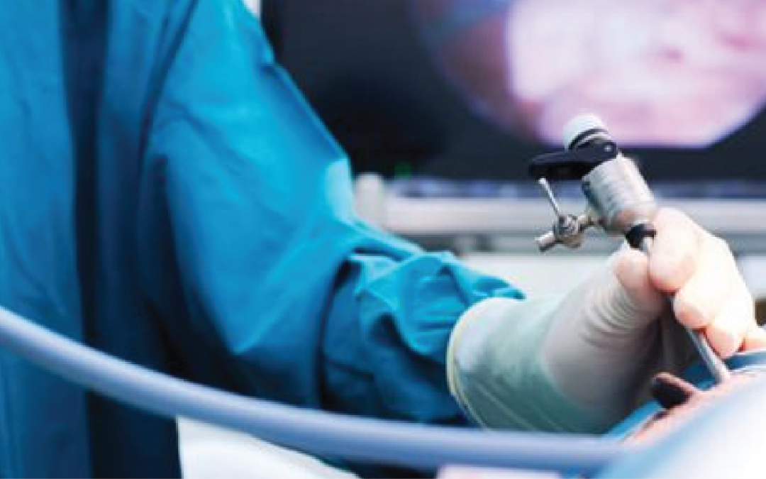 laparoscopia apendicectomia