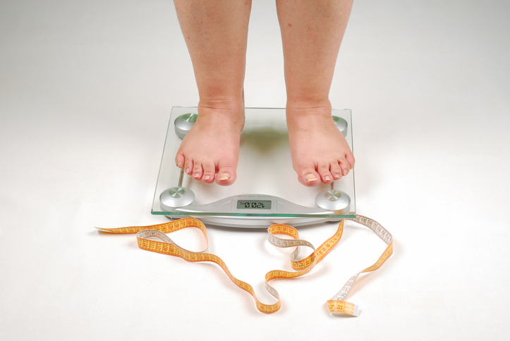 cirurgia bariátrica