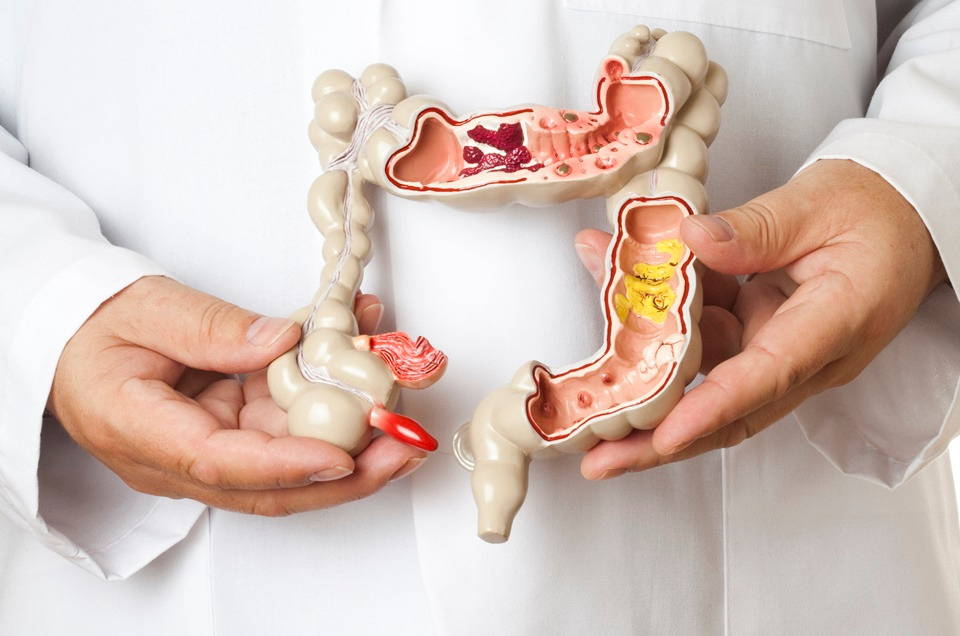 cirurgia colorretal