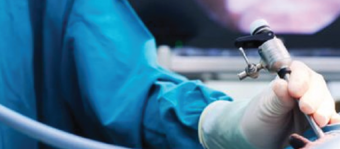 laparoscopia apendicectomia