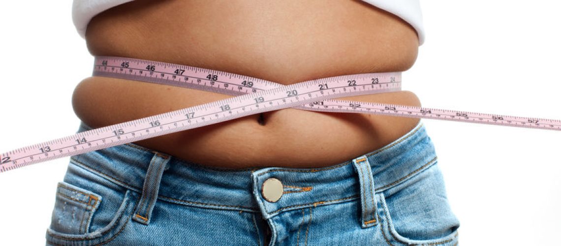 Cirurgia bariátrica