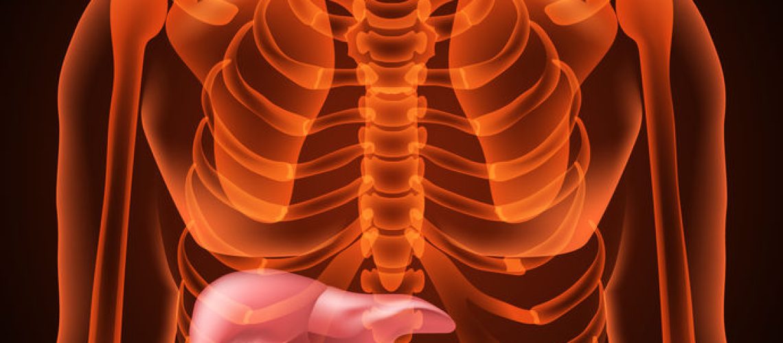 cálculo na vesícula