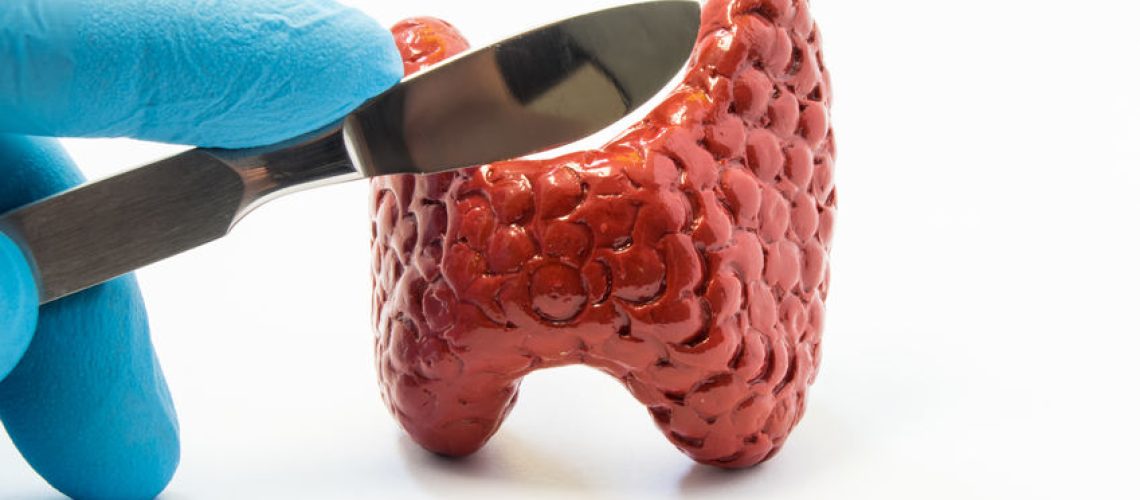 tireoidectomia total