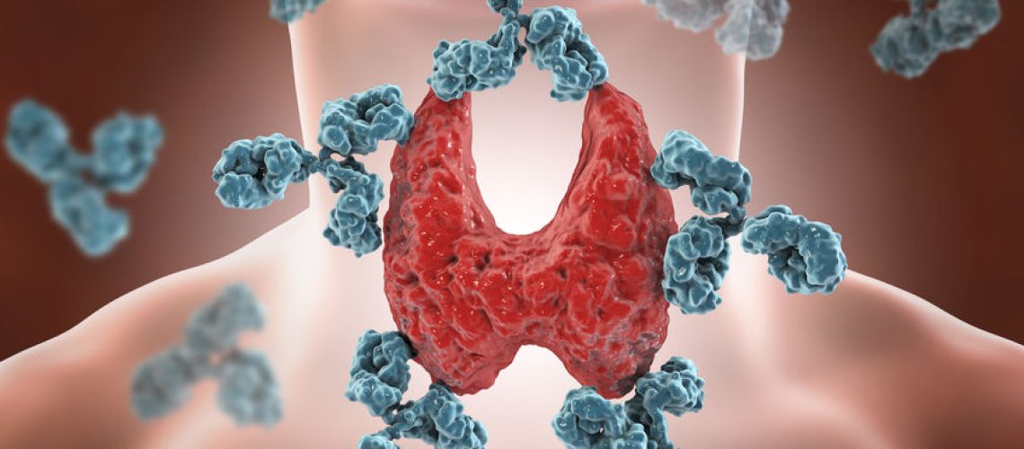 Tireoidite de hashimoto