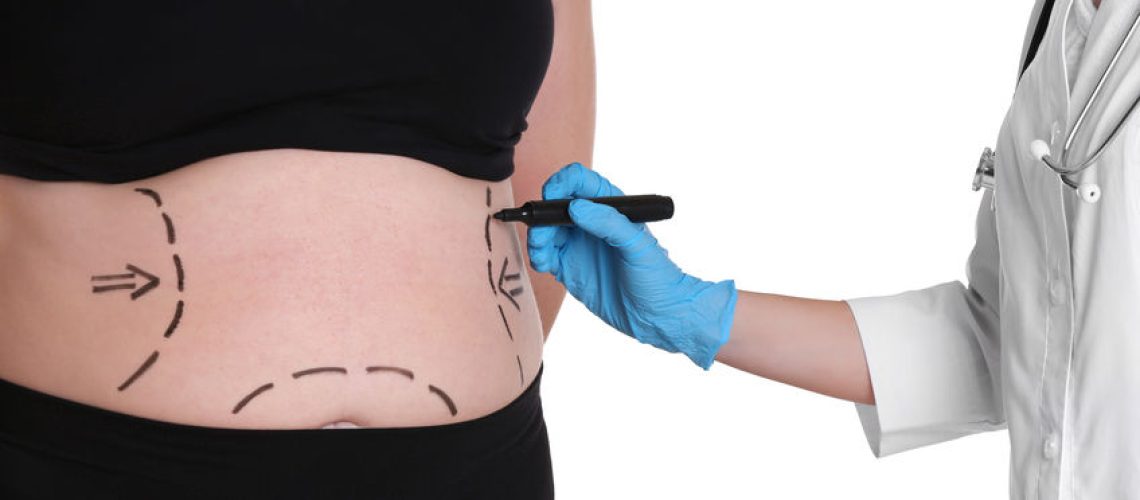 Cirurgia para emagrecimento