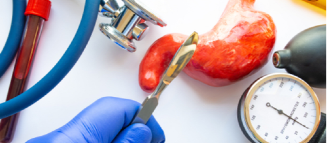 cirurgia bariátrica