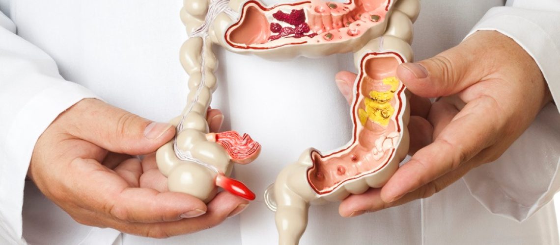 cirurgia colorretal