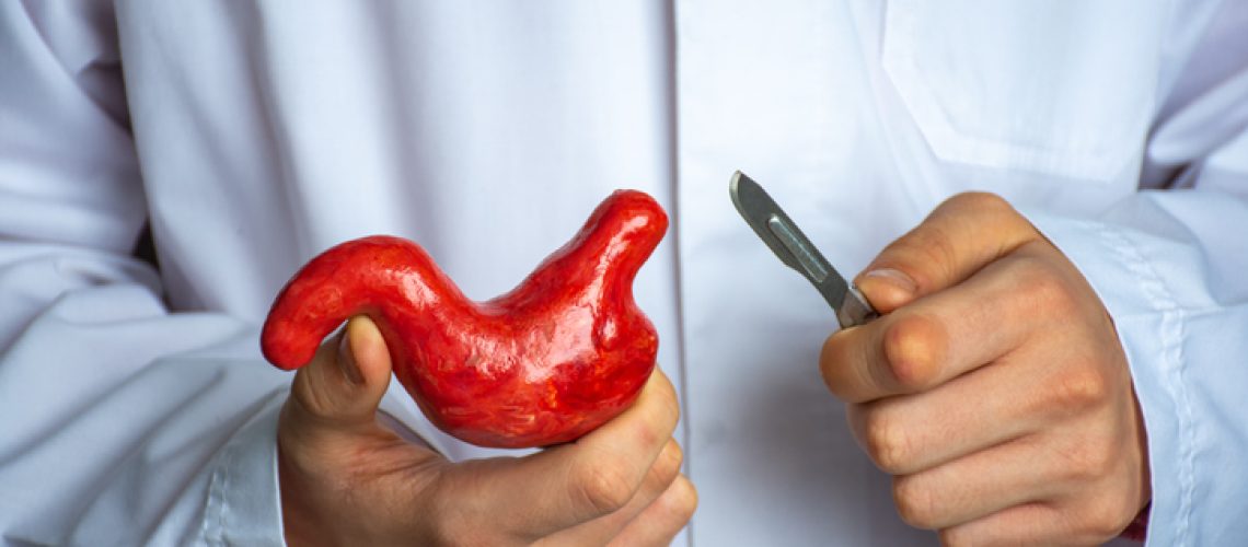 redução de estômago