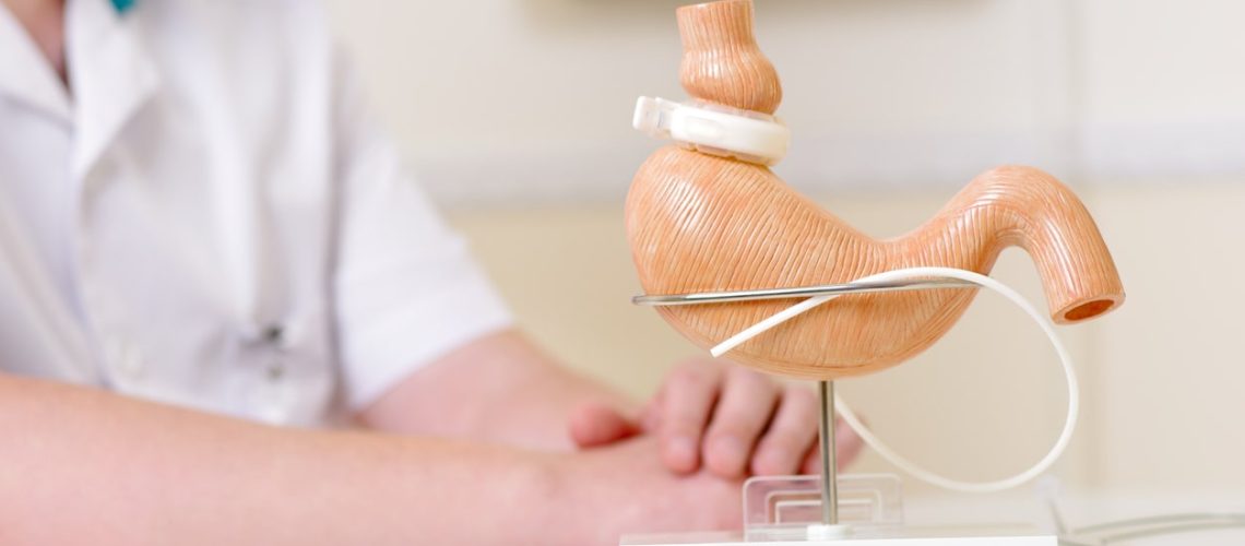 Banda Gástrica Ajustável