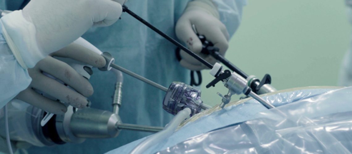 Cirurgia Colorretal por videolaparoscopia